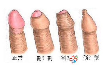 切包皮什么技術(shù)好_九江醫(yī)大醫(yī)院