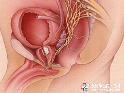 前列腺增生有哪些危害？九江醫(yī)大醫(yī)院