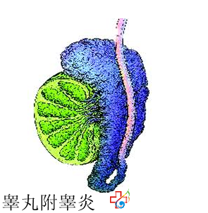 睪丸附睪炎一般都有哪些危害呢？九江醫大醫院