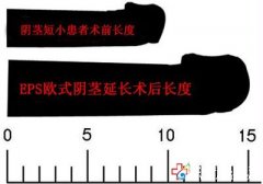 為什么陰莖那么短？應該