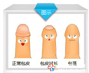 包皮整形還你真“性福”！石河子五洲醫院