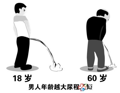 九江治療前列腺增生什么技術好？—九江男科醫院