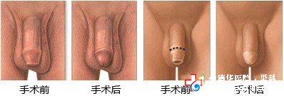 九江做包皮哪家醫(yī)院好