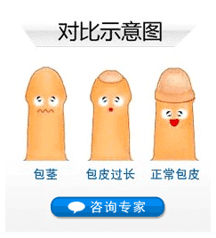 包皮過長是否影響生育